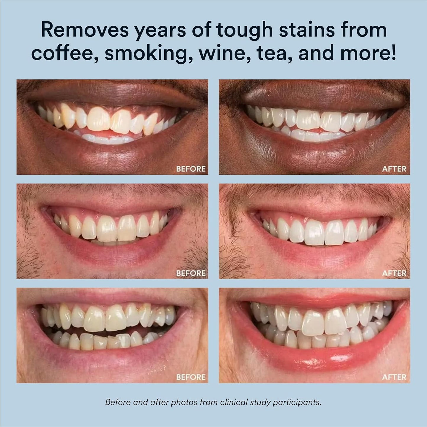 Rapid Teeth Whitening Kit